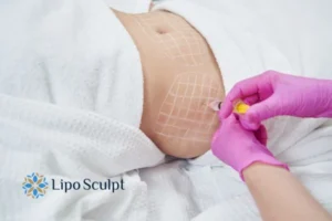Are The Results From Aqualyx Permanent? 1 Do you want to know how long Aqualyx Islington results last?