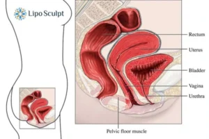 Treatment For A Leaky Bladder 2 How EM Chair treatment Islington can help Leaky bladder issues. Read more now!