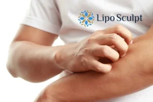 Best Actinic Keratoses Removal 4 prevent your actinic keratoses Islington getting worse - call our team today!