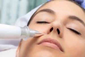Best Actinic Keratoses Removal 3 Actinic keratoses Islington solutions - book in today!