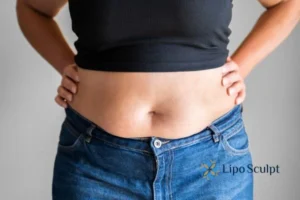 Bidding Farewell to Muffin Tops with Aqualyx Fat Injections 2 Do you wish you could reduce your muffin top Islington With Aqualy fat dissolving injections you can!