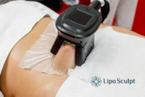Does Fat Freezing At Home Work? 3 Fat freezing at home from Lipo Sculpt Islington